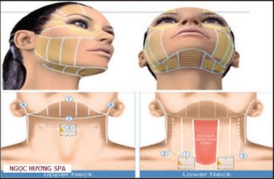 Nâng cơ trắng sáng da với công nghệ Ultherapy RF – không phẫu thuật